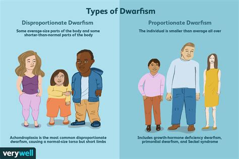 proportionate dwarfism pictures|proportionate vs disproportionate dwarfism.